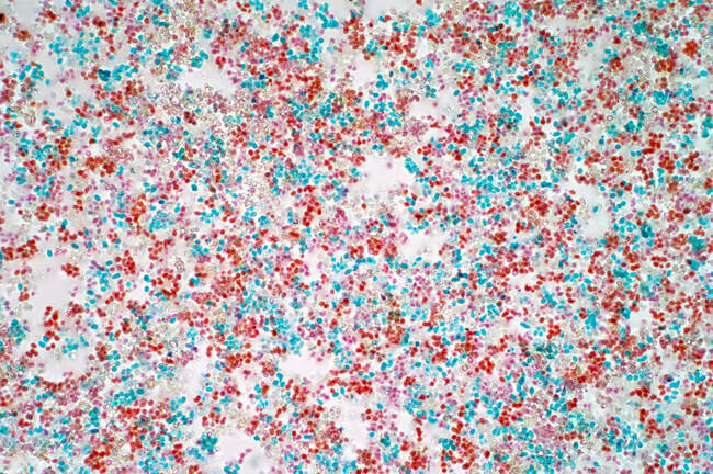 Light micrograph of brewer's yeast (Saccharomyces cerevisiae) yeast budding cells. Saccharomyces cerevisiae is able to ferment sugar, producing alcohol and carbon dioxide in the process. It has long been used in the brewing of beer, production of win — Stock Photo